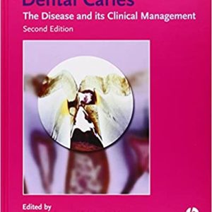 Dental Caries: The Disease and Its Clinical Management 2nd Edition