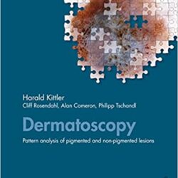 Дерматоскопия: анализ структуры пигментированных и беспигментных поражений.