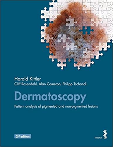 Dermatoscopy Pattern analysis of pigmented and non pigmented lesions