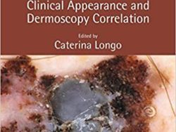 Diagnosing the Less Common Skin Tumors: Clinical Appearance and Dermoscopy Correlation 1st Edition