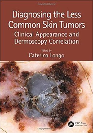 Diagnosing the Less Common Skin Tumors: Clinical Appearance and Dermoscopy Correlation 1st Edition