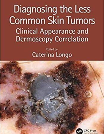 Diagnosing the Less Common Skin Tumors: Clinical Appearance and Dermoscopy Correlation 1st Edition