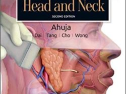 Diagnostic Ultrasound: Head and Neck 2nd Edition