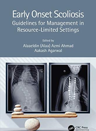 Early Onset Scoliosis: Guidelines for Management in Resource-Limited Settings