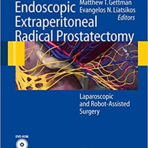 Endoscopic Extraperitoneal Radical Prostatectomy: Laparoscopic and Robot-Assisted Surgery 2007th Edition