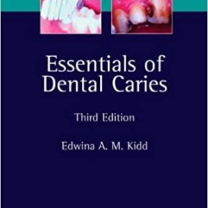 Essentials of Dental Caries: The Disease and Its Management 3rd Edition