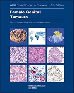 Female Genital Tumours: WHO Classification of Tumours, 5th Edition Fifth ed/5e