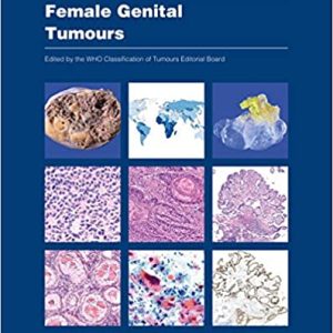 Female Genital Tumours: WHO Classification of Tumours, 5th Edition Fifth ed/5e