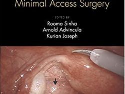 Fibroid Uterus: Surgical Challenges in Minimal Access Surgery 1st Edition