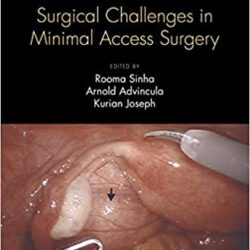 Fibroid Uterus: Surgical Challenges in Minimal Access Surgery 1st Edition