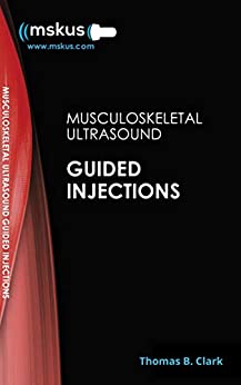 Handbook of Ultrasound Guided Injections: (5th ed/5e) Fifth Edition