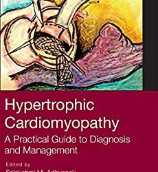 Hypertrophic Cardiomyopathy: A Practical Guide to Diagnosis and Management 1st Edition