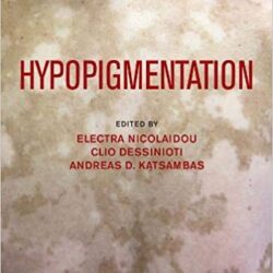 Hypopigmentierung 1. Auflage
