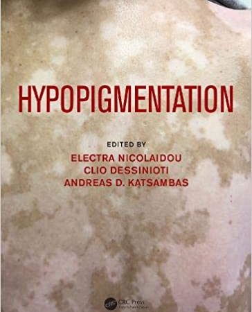 Hypopigmentation 1st Edition
