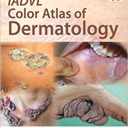 Атлас цветов дерматологии IADVL, 1-е издание