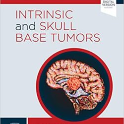 Tumores intrínsecos y de la base del cráneo – Libro electrónico: Neurocirugía: Serie de comparación de gestión de casos – PDF original