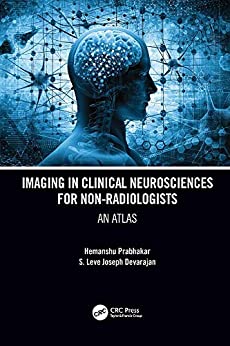 Imaging in Clinical Neurosciences for Non radiologists