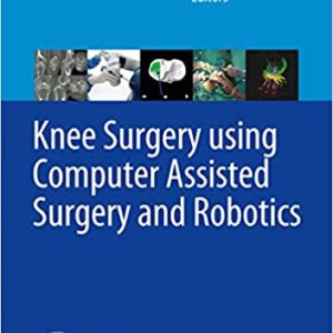 Knee Surgery using Computer Assisted Surgery and Robotics