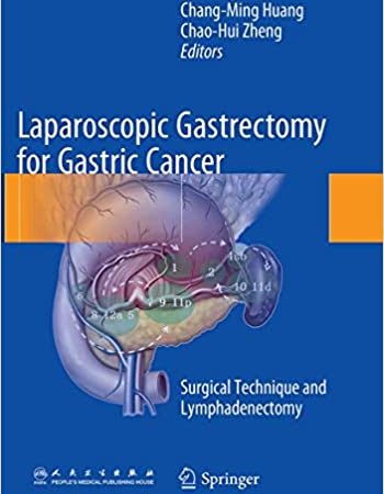 Laparoscopic Gastrectomy for Gastric Cancer: Surgical Technique and Lymphadenectomy 2015th Edition