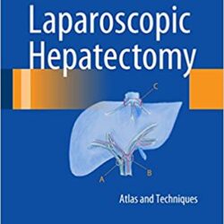 Лапароскопическая гепатэктомия: Атлас и методы, издание 2015 г.
