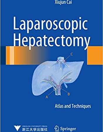 Laparoscopic Hepatectomy: Atlas and Techniques 2015th Edition