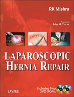 Laparoscopic Hernia Repair 1st Edition