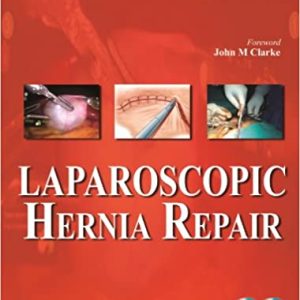 Laparoscopic Hernia Repair 1st Edition