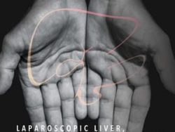 Laparoscopic Liver, Pancreas, and Biliary Surgery, Textbook and Illustrated Video Atlas