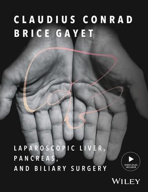 Laparoscopic Liver Pancreas and Biliary Surgery Textbook and Illustrated Video Atlas