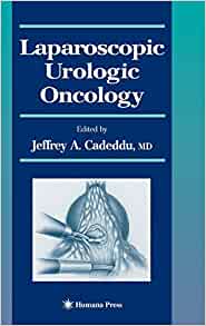 Oncología Urológica Laparoscópica