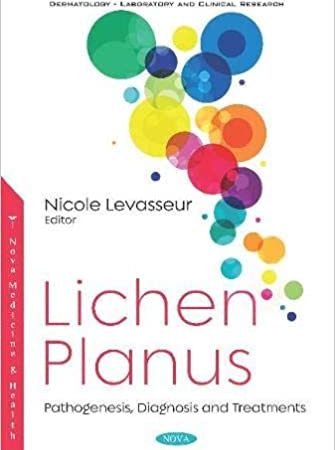 Lichen Planus: Pathogenesis, Diagnosis and Treatments