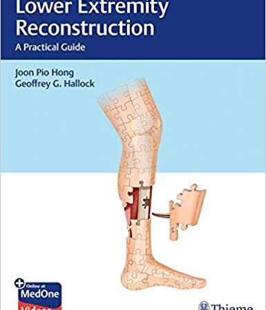 Lower Extremity Reconstruction: A Practical Guide