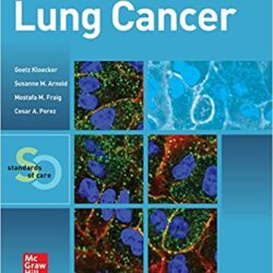Cancer du poumon : normes de soins 1re édition