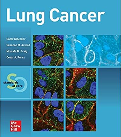 Lung Cancer: Standards of Care 1st Edition