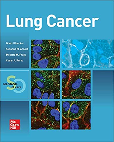 Lung Cancer: Standards of Care 1st Edition