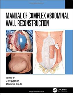 Manual of Complex Abdominal Wall Reconstruction 1st Edition