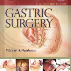 Master Techniques in Surgery: Gastric Surgery [1st ed/1e] FIRST Edition