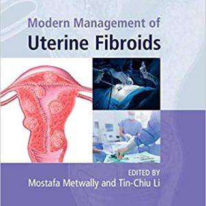 Modern Management of Uterine Fibroids