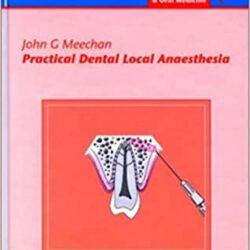 Practical Dental Local Anaesthesia (Oral Surgery) 1st Edition