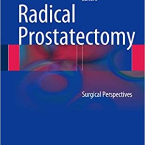 Radical Prostatectomy: Surgical Perspectives