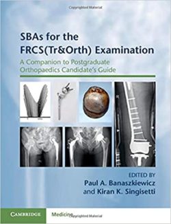 SBAs for the FRCS (Tr&Orth) Examination TRAUMA and ORTHO (A Companion to Postgraduate Orthopaedics Candidate’s Guide) 1st Edition