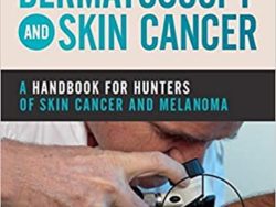 Dermatoscopy and Skin Cancer: A handbook for hunters of skin cancer and melanoma
