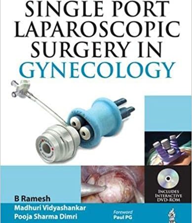 Single-Port Laparoscopic Surgery in Gynecology 1st Edition