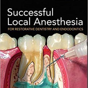 Successful Local Anesthesia for Restorative Dentistry and Endodontics 1st Edition