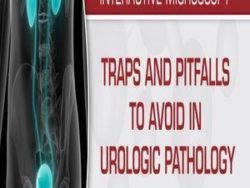USCAP Traps And Pitfalls To Avoid In Urologic Pathology 2019