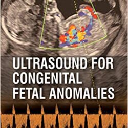 Échographie pour les anomalies fœtales congénitales 1ère édition