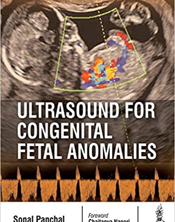 Ultrasound for Congenital Fetal Anomalies 1st Edition