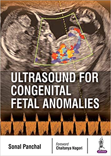 Échographie pour les anomalies fœtales congénitales 1ère édition
