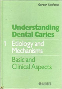 Understanding Dental Caries: Etiology and Mechanisms : Basic and Clinical Aspects