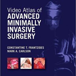 Vídeo Atlas de Cirurgia Minimamente Invasiva Avançada
